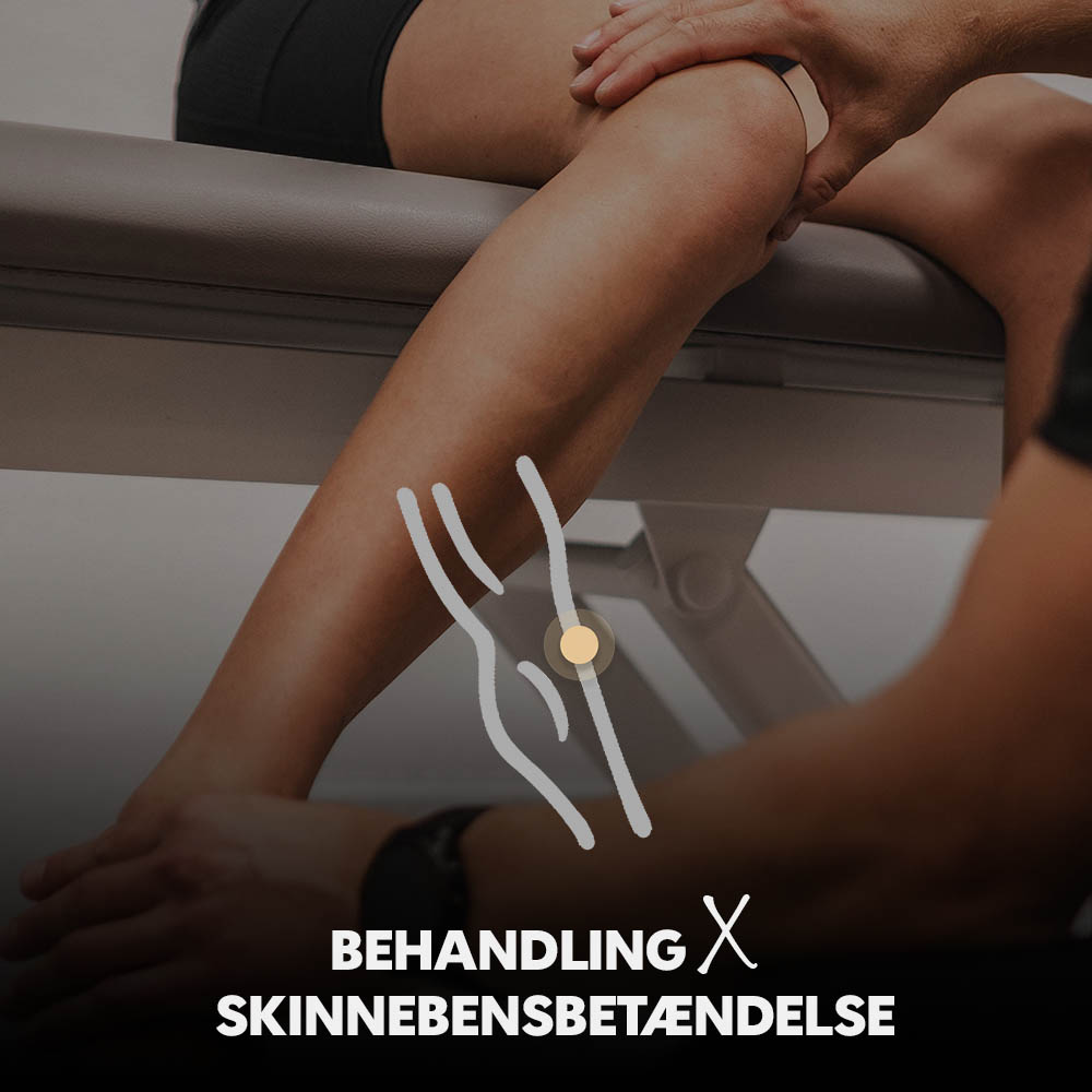 <p style="line-height: 28px; text-align: left;"><span style="font-size: 16px; color: #333333;"><strong>Især løbere døjer med ømme skinneben. Vi kan hjælpe dig.</strong></span></p> <p style="line-height: 28px; text-align: left;"><span style="font-size: 14px;"><a href="https://kso.dk/klinik-behandling-skinnebensbetaendelse"><span style="text-decoration: underline;">Læs mere</span></a></span></p>